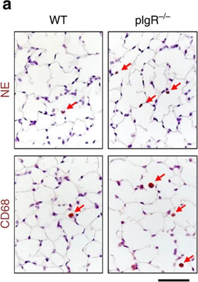 Immunohistochemistry - Anti-Neutrophil Elastase antibody (AB68672)