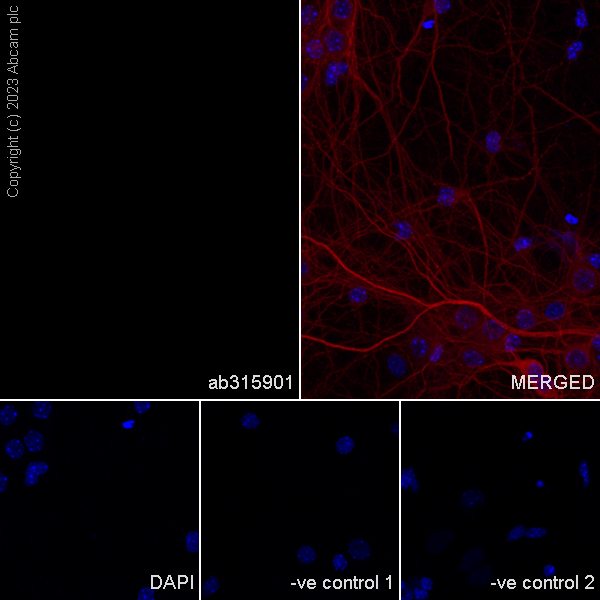Immunocytochemistry/ Immunofluorescence - Anti-Neutrophil Elastase antibody [EPR28386-175] (AB315901), expandable thumbnail