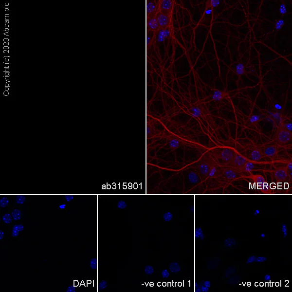 Immunocytochemistry/ Immunofluorescence - Anti-Neutrophil Elastase antibody [EPR28386-175] (AB315901)