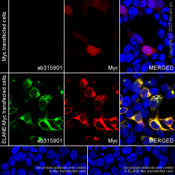 Immunocytochemistry/ Immunofluorescence - Anti-Neutrophil Elastase antibody [EPR28386-175] (AB315901), expandable thumbnail