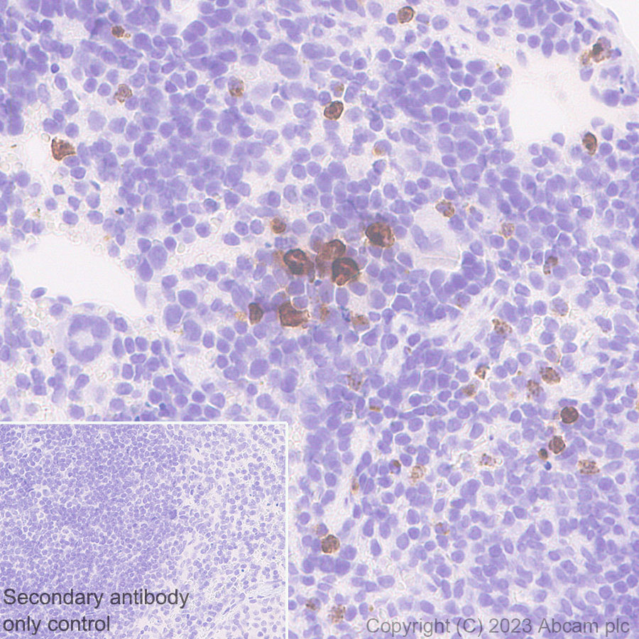 Immunohistochemistry (Formalin/PFA-fixed paraffin-embedded sections) - Anti-Neutrophil Elastase antibody [EPR28386-175] (ab315901), expandable thumbnail
