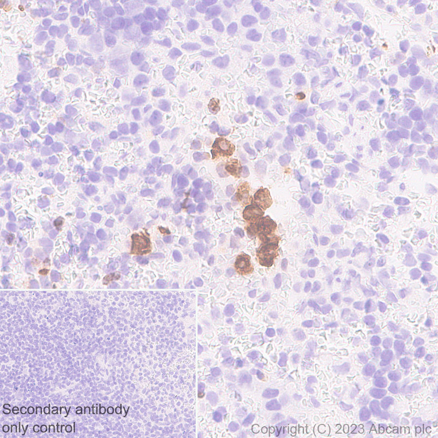 Immunohistochemistry (Formalin/PFA-fixed paraffin-embedded sections) - Anti-Neutrophil Elastase antibody [EPR28386-175] (ab315901), expandable thumbnail