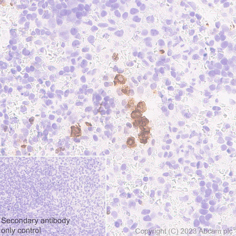 Immunohistochemistry (Formalin/PFA-fixed paraffin-embedded sections) - Anti-Neutrophil Elastase antibody [EPR28386-175] (AB315901)