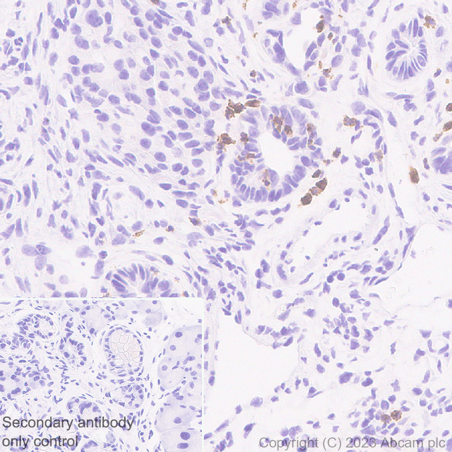 Immunohistochemistry (Formalin/PFA-fixed paraffin-embedded sections) - Anti-Neutrophil Elastase antibody [EPR28386-175] (ab315901), expandable thumbnail