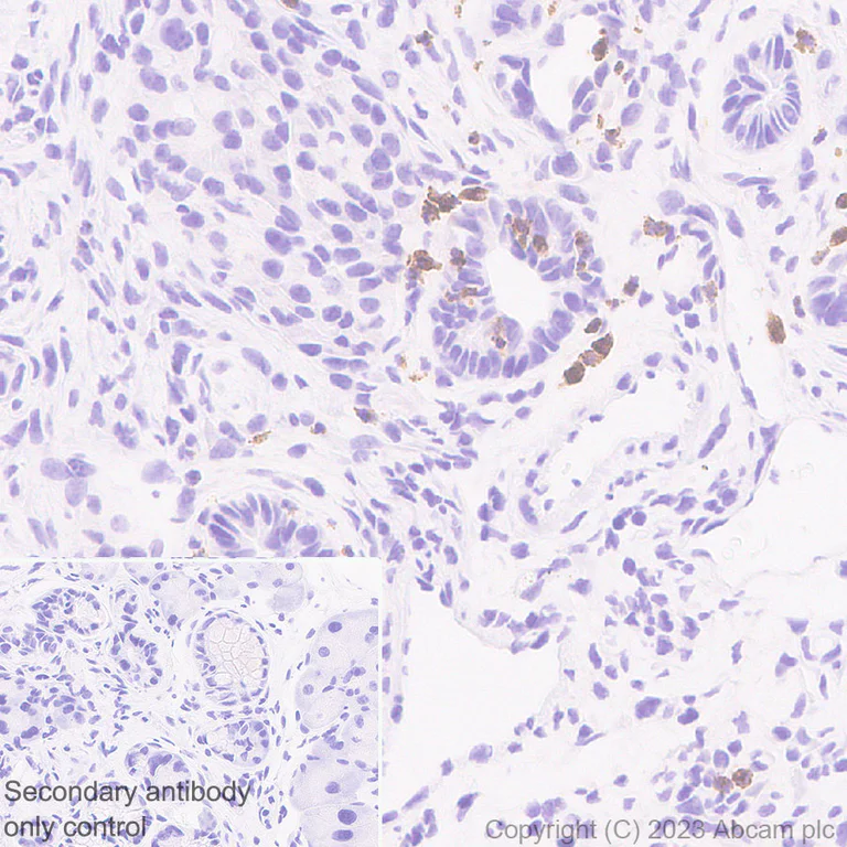 Immunohistochemistry (Formalin/PFA-fixed paraffin-embedded sections) - Anti-Neutrophil Elastase antibody [EPR28386-175] (AB315901)