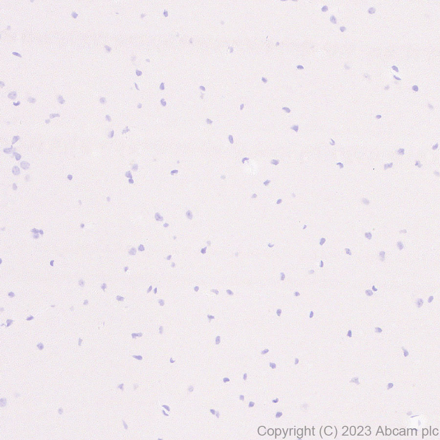 Immunohistochemistry (Formalin/PFA-fixed paraffin-embedded sections) - Anti-Neutrophil Elastase antibody [EPR28386-175] (AB315901), expandable thumbnail