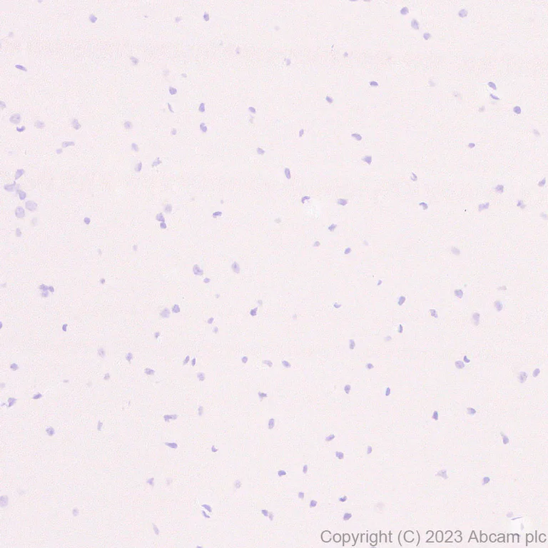 Immunohistochemistry (Formalin/PFA-fixed paraffin-embedded sections) - Anti-Neutrophil Elastase antibody [EPR28386-175] (AB315901)