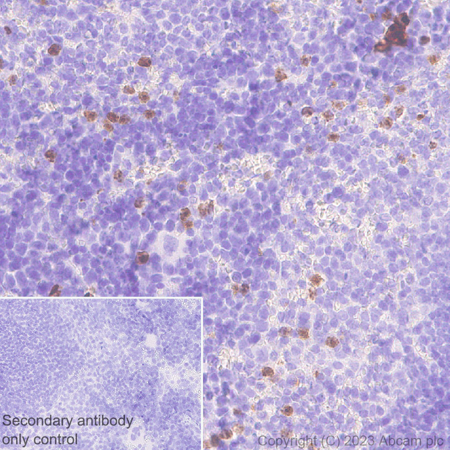 Immunohistochemistry (Formalin/PFA-fixed paraffin-embedded sections) - Anti-Neutrophil Elastase antibody [EPR28386-66] (ab310335), expandable thumbnail