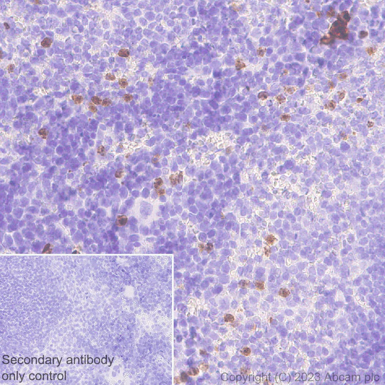 Immunohistochemistry (Formalin/PFA-fixed paraffin-embedded sections) - Anti-Neutrophil Elastase antibody [EPR28386-66] (AB310335)
