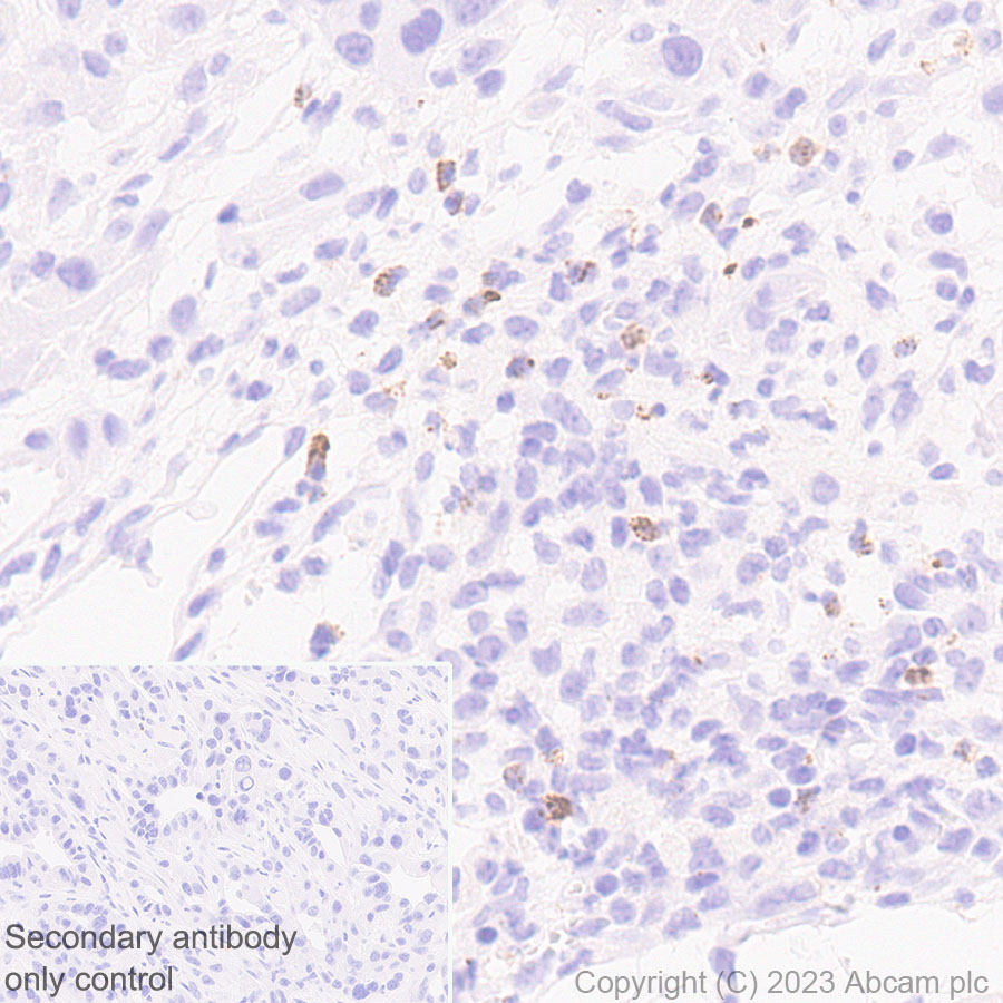 Immunohistochemistry (Formalin/PFA-fixed paraffin-embedded sections) - Anti-Neutrophil Elastase antibody [EPR28386-66] (ab310335), expandable thumbnail