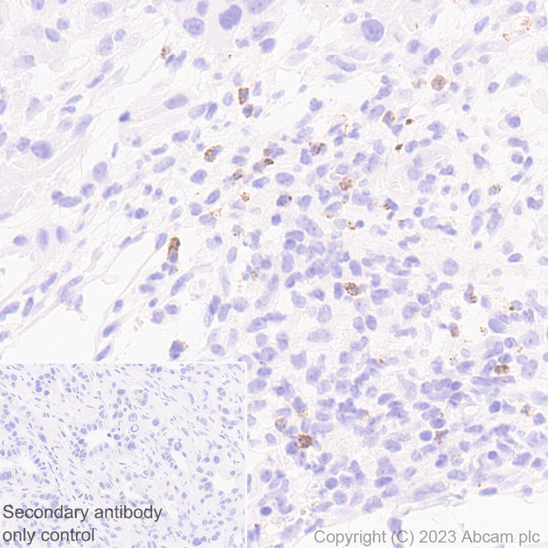Immunohistochemistry (Formalin/PFA-fixed paraffin-embedded sections) - Anti-Neutrophil Elastase antibody [EPR28386-66] (AB310335)
