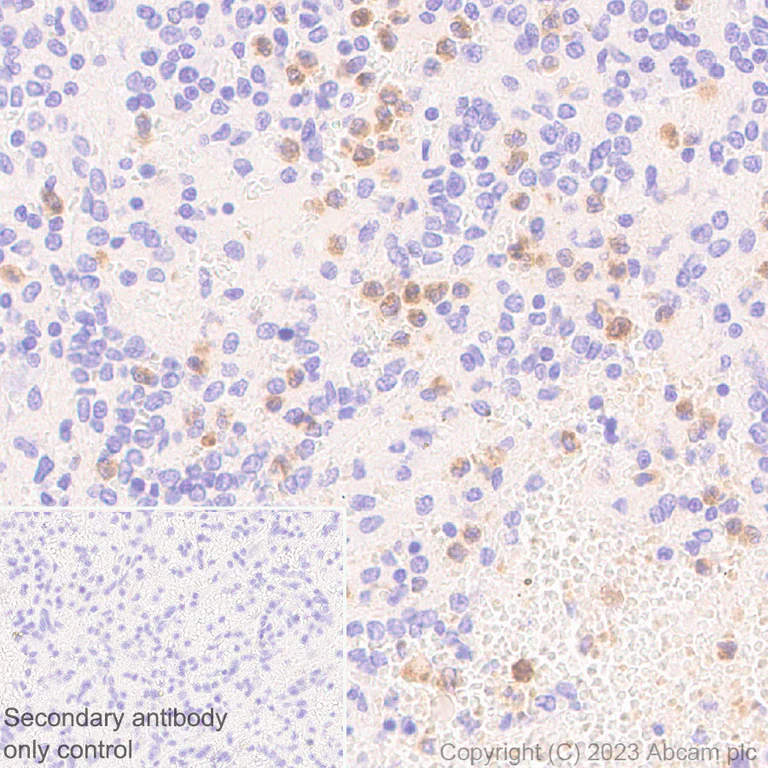 Immunohistochemistry (Formalin/PFA-fixed paraffin-embedded sections) - Anti-Neutrophil Elastase antibody [EPR28386-66] (AB310335)