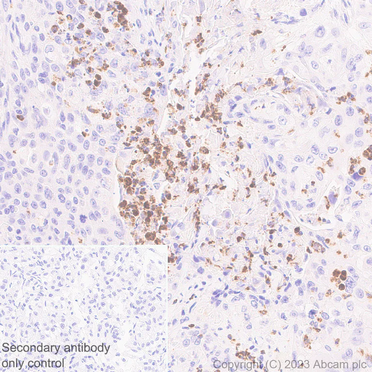 Immunohistochemistry (Formalin/PFA-fixed paraffin-embedded sections) - Anti-Neutrophil Elastase antibody [EPR28386-66] (AB310335)
