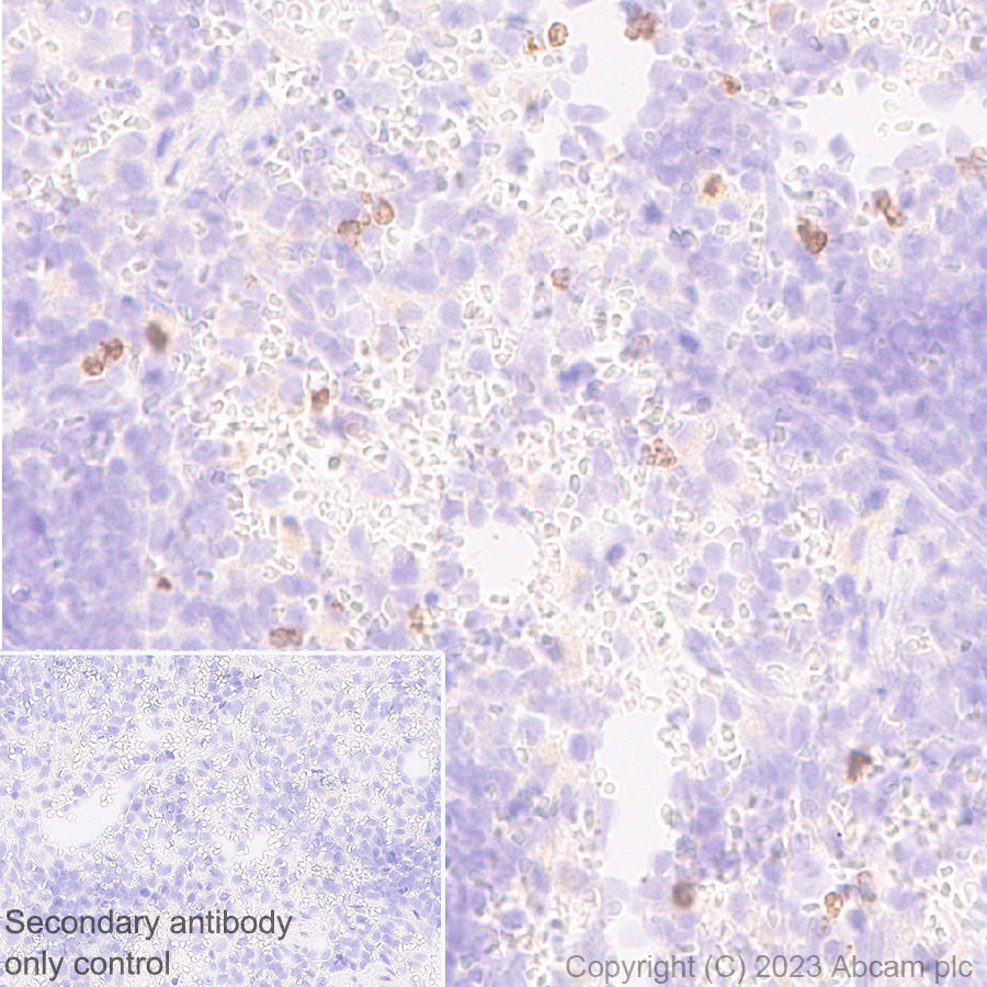 Immunohistochemistry (Formalin/PFA-fixed paraffin-embedded sections) - Anti-Neutrophil Elastase antibody [EPR28386-66] (ab310335), expandable thumbnail