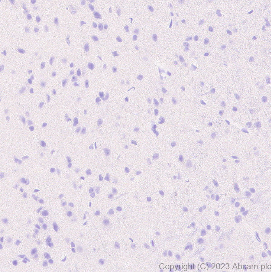 Immunohistochemistry (Formalin/PFA-fixed paraffin-embedded sections) - Anti-Neutrophil Elastase antibody [EPR28386-66] (ab310335), expandable thumbnail