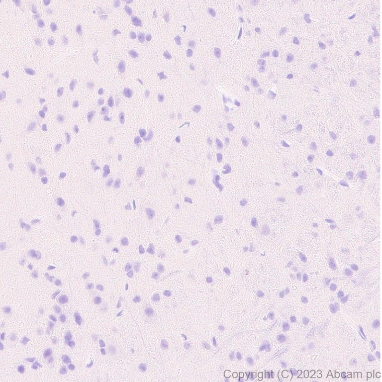 Immunohistochemistry (Formalin/PFA-fixed paraffin-embedded sections) - Anti-Neutrophil Elastase antibody [EPR28386-66] (AB310335)