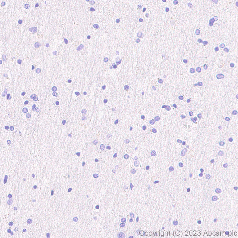Immunohistochemistry (Formalin/PFA-fixed paraffin-embedded sections) - Anti-Neutrophil Elastase antibody [EPR28386-66] (AB310335)