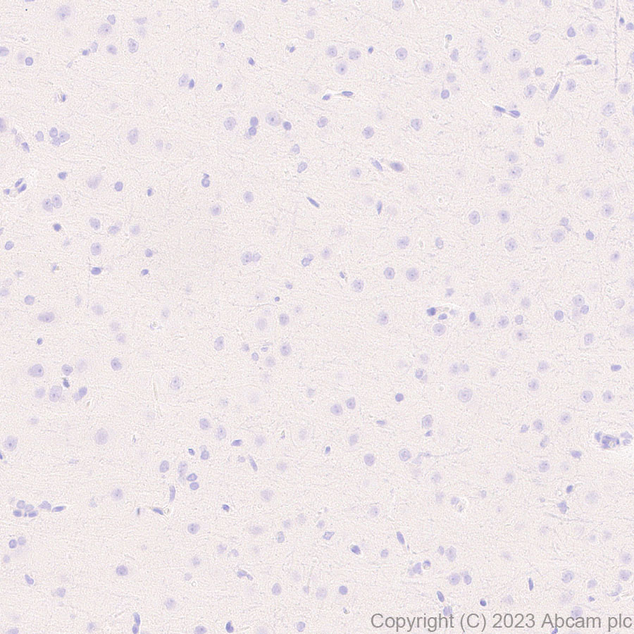 Immunohistochemistry (Formalin/PFA-fixed paraffin-embedded sections) - Anti-Neutrophil Elastase antibody [EPR28386-66] (ab310335), expandable thumbnail