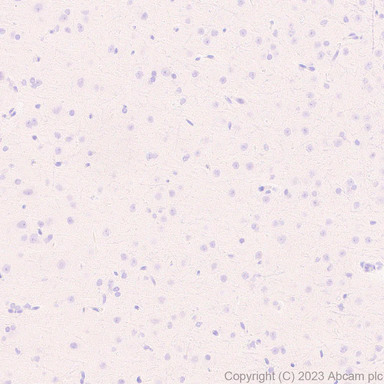 Immunohistochemistry (Formalin/PFA-fixed paraffin-embedded sections) - Anti-Neutrophil Elastase antibody [EPR28386-66] (AB310335)