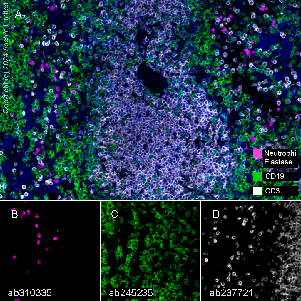 Multiplex immunohistochemistry - Anti-Neutrophil Elastase antibody [EPR28386-66] (AB310335), expandable thumbnail