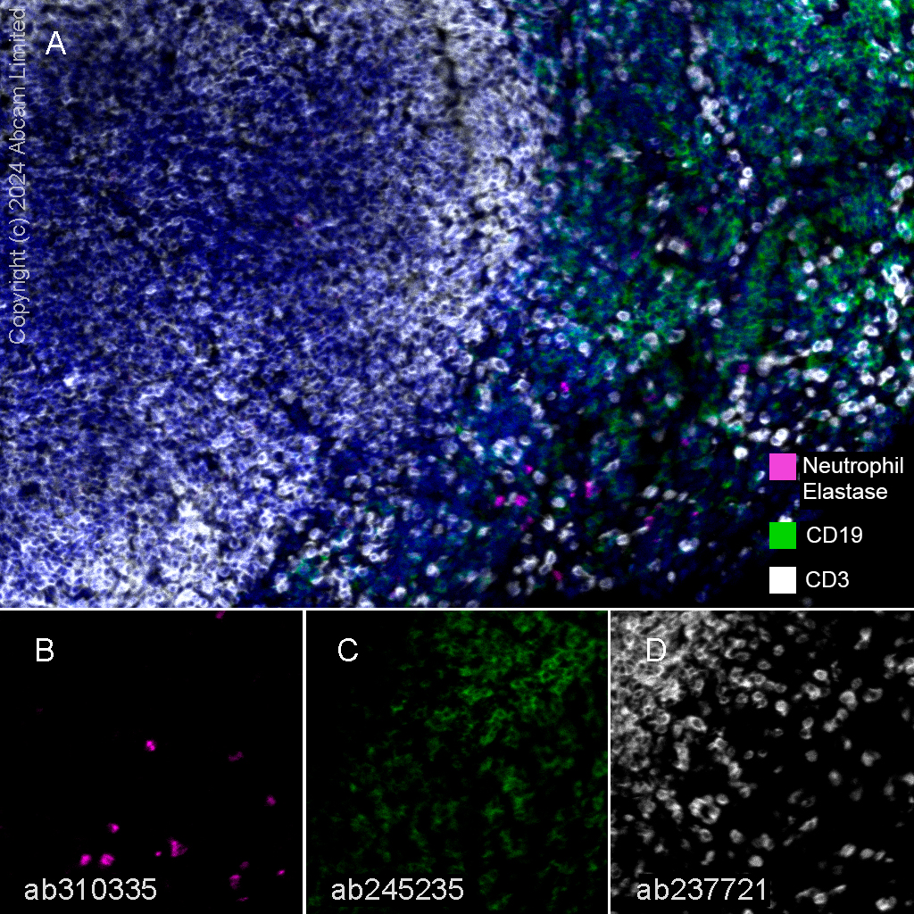 Multiplex immunohistochemistry - Anti-Neutrophil Elastase antibody [EPR28386-66] (ab310335), expandable thumbnail