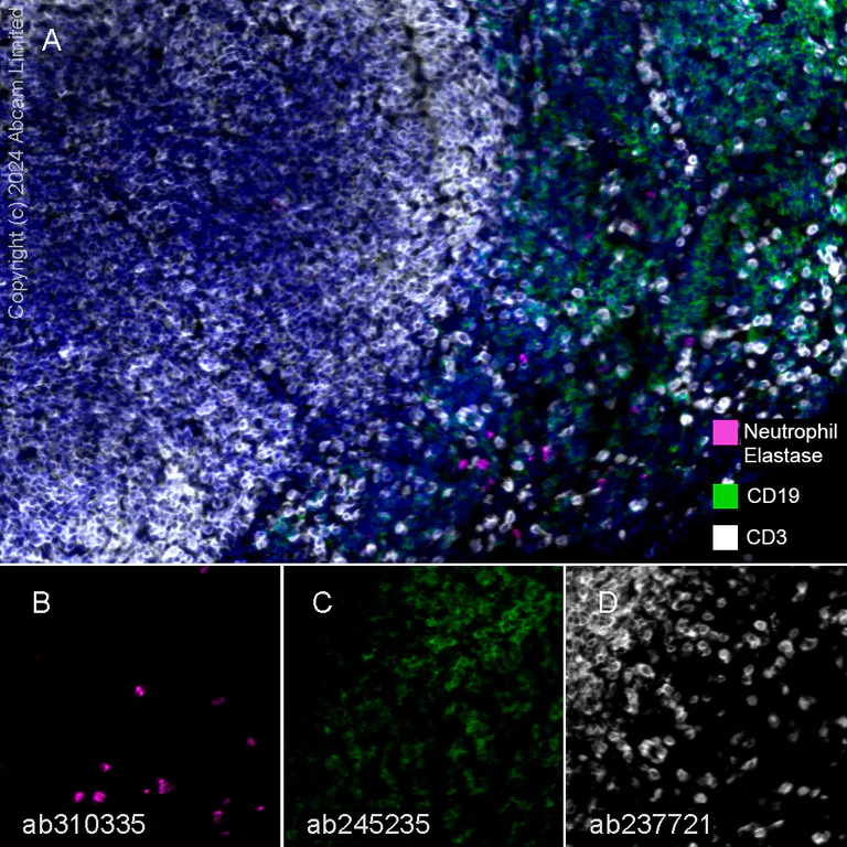 Multiplex immunohistochemistry - Anti-Neutrophil Elastase antibody [EPR28386-66] (AB310335)