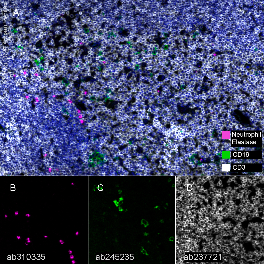 Multiplex immunohistochemistry - Anti-Neutrophil Elastase antibody [EPR28386-66] (AB310335), expandable thumbnail