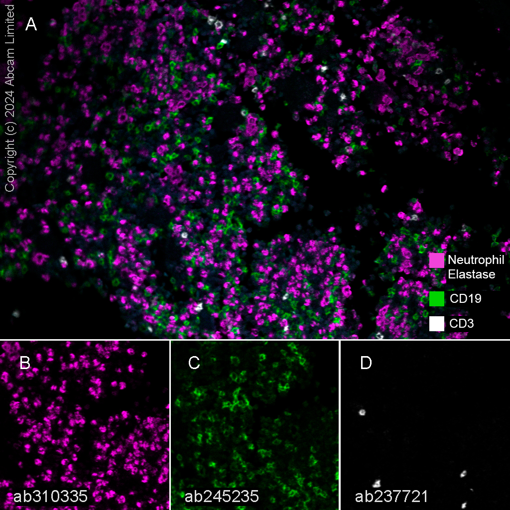 Multiplex immunohistochemistry - Anti-Neutrophil Elastase antibody [EPR28386-66] (AB310335), expandable thumbnail
