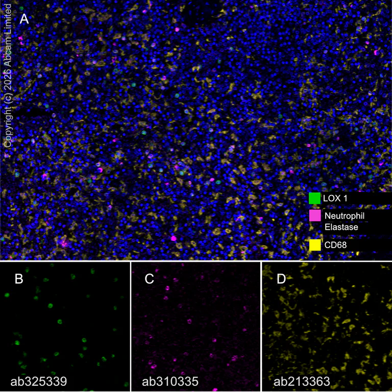 Multiplex immunohistochemistry - Anti-Neutrophil Elastase antibody [EPR28386-66] (AB310335)