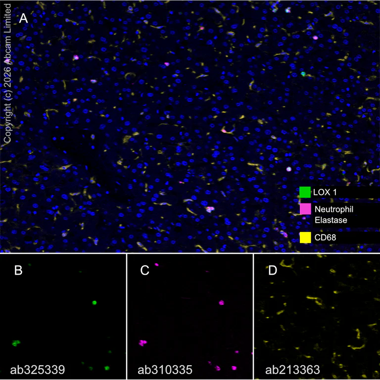 Multiplex immunohistochemistry - Anti-Neutrophil Elastase antibody [EPR28386-66] (AB310335)