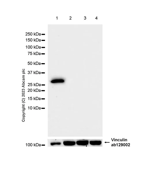 Western blot - Anti-Neutrophil Elastase antibody [EPR28386-66] (AB310335)