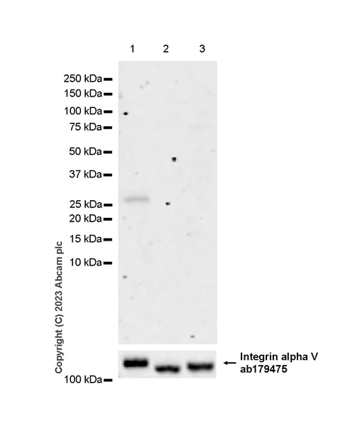Western blot - Anti-Neutrophil Elastase antibody [EPR28386-66] (AB310335)