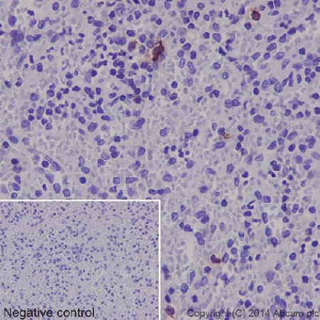 Immunohistochemistry (Formalin/PFA-fixed paraffin-embedded sections) - Anti-Neutrophil Elastase antibody [EPR7479] (AB131260), expandable thumbnail