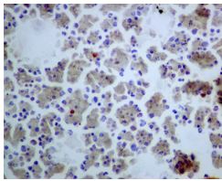 Immunohistochemistry (Formalin/PFA-fixed paraffin-embedded sections) - Anti-Neutrophil Elastase antibody [EPR7479] (AB131260), expandable thumbnail