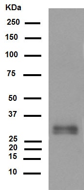 Western blot - Anti-Neutrophil Elastase antibody [EPR7479] (ab131260), expandable thumbnail