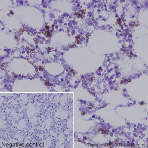 Immunohistochemistry (Formalin/PFA-fixed paraffin-embedded sections) - Anti-Neutrophil Elastase antibody [EPR7479] - BSA and Azide free (AB219585)