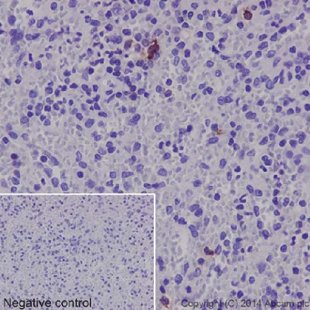 Immunohistochemistry (Formalin/PFA-fixed paraffin-embedded sections) - Anti-Neutrophil Elastase antibody [EPR7479] - BSA and Azide free (AB219585)