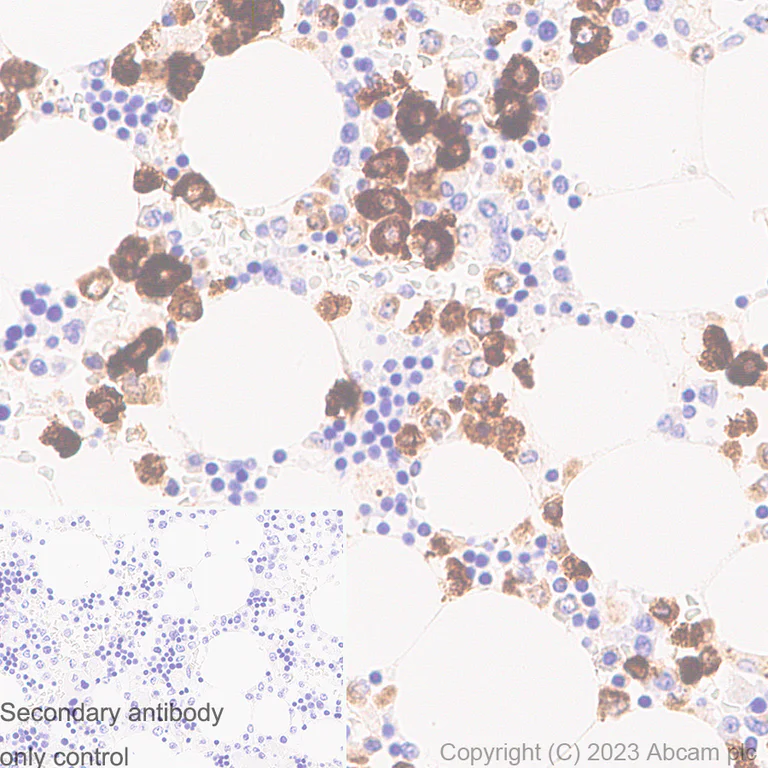 Immunohistochemistry (Formalin/PFA-fixed paraffin-embedded sections) - Anti-Neutrophil Elastase antibody [RM1077] - BSA and Azide free (AB314917)
