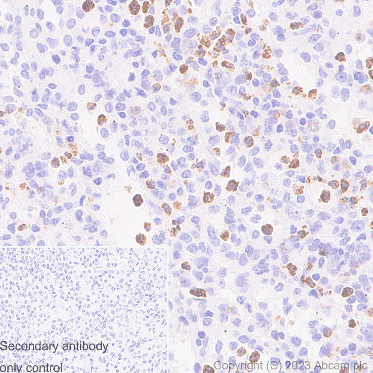 Immunohistochemistry (Formalin/PFA-fixed paraffin-embedded sections) - Anti-Neutrophil Elastase antibody [RM1077] - BSA and Azide free (AB314917)