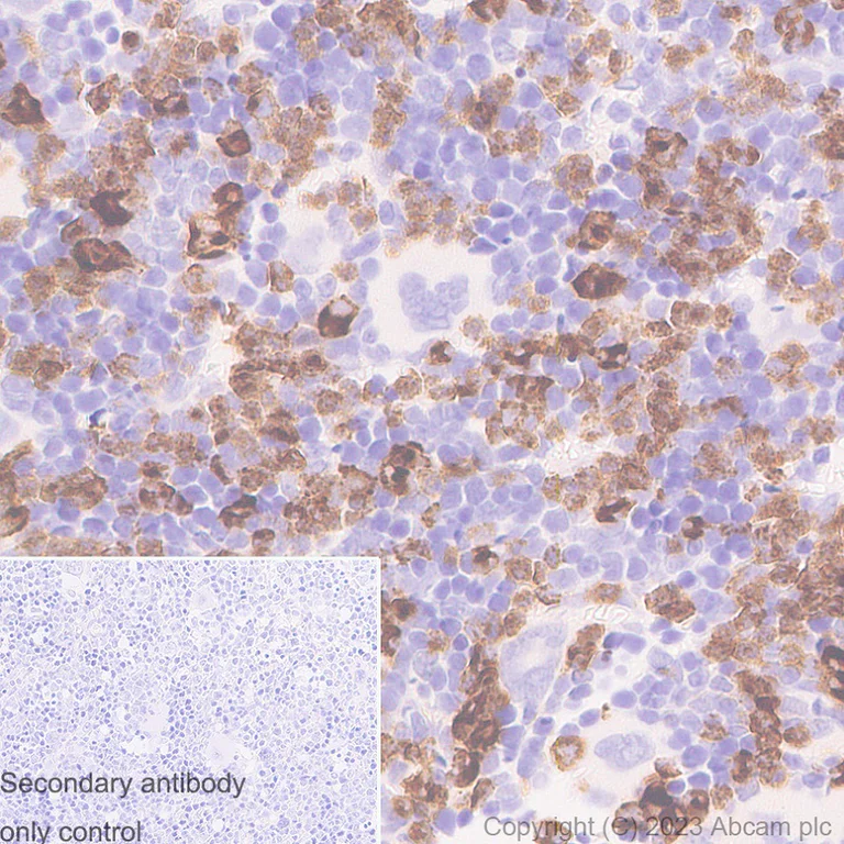 Immunohistochemistry (Formalin/PFA-fixed paraffin-embedded sections) - Anti-Neutrophil Elastase antibody [RM1077] - BSA and Azide free (AB314917)