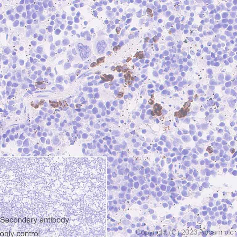 Immunohistochemistry (Formalin/PFA-fixed paraffin-embedded sections) - Anti-Neutrophil Elastase antibody [RM1077] - BSA and Azide free (AB314917)