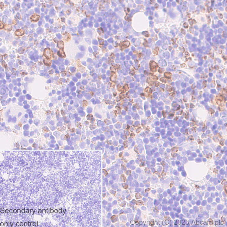 Immunohistochemistry (Formalin/PFA-fixed paraffin-embedded sections) - Anti-Neutrophil Elastase antibody [RM1077] - BSA and Azide free (AB314917)