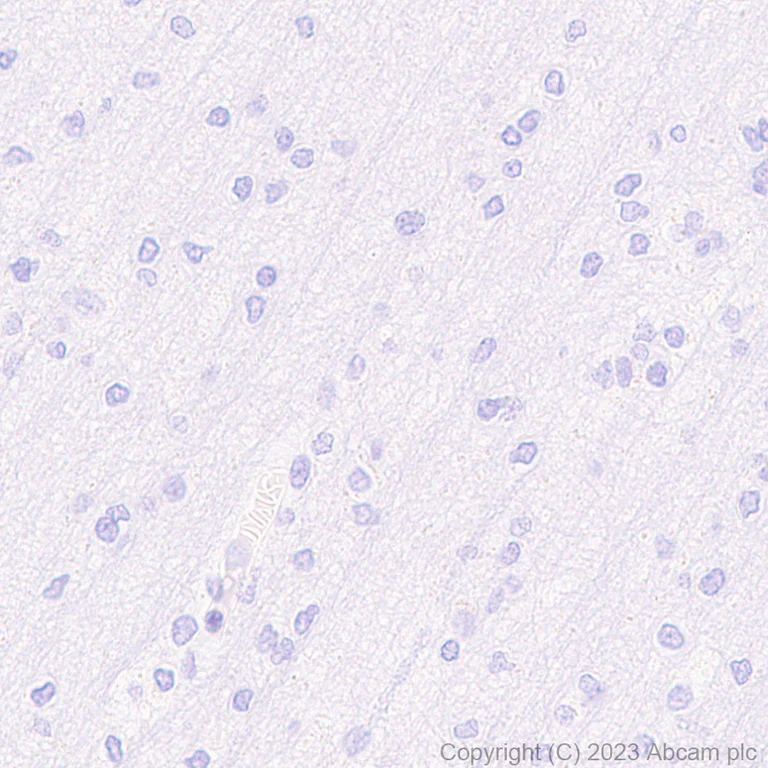 Immunohistochemistry (Formalin/PFA-fixed paraffin-embedded sections) - Anti-Neutrophil Elastase antibody [RM1077] - BSA and Azide free (AB314917)