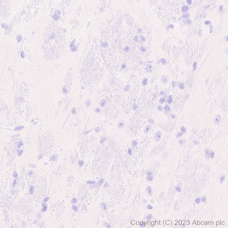 Immunohistochemistry (Formalin/PFA-fixed paraffin-embedded sections) - Anti-Neutrophil Elastase antibody [RM1077] - BSA and Azide free (AB314917)