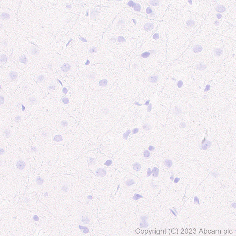 Immunohistochemistry (Formalin/PFA-fixed paraffin-embedded sections) - Anti-Neutrophil Elastase antibody [RM1077] - BSA and Azide free (AB314917)