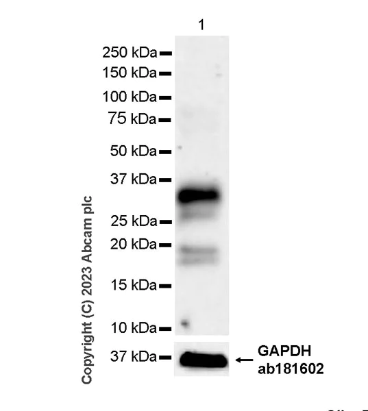 Western blot - Anti-Neutrophil Elastase antibody [RM1077] - BSA and Azide free (AB314917)