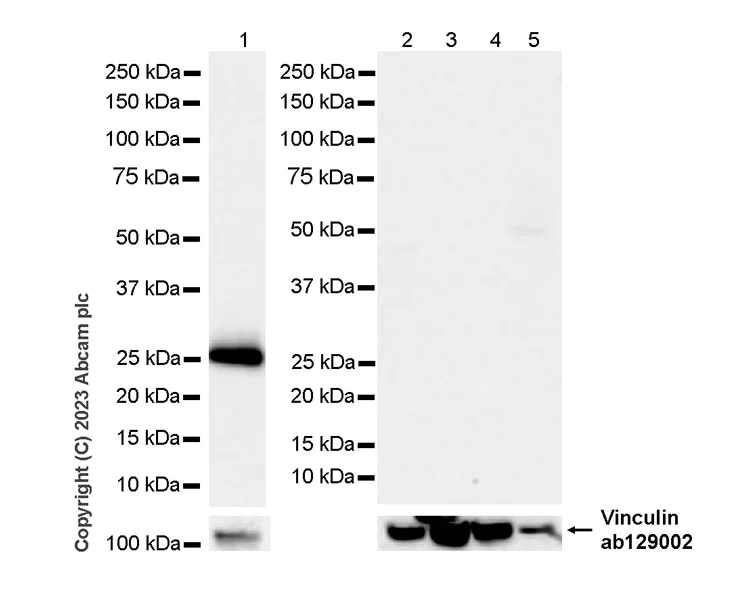 Western blot - Anti-Neutrophil Elastase antibody [RM1077] - BSA and Azide free (AB314917)