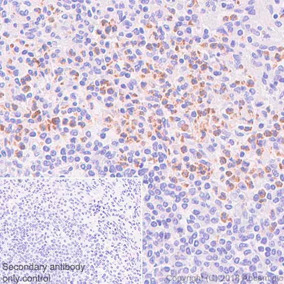 Immunohistochemistry (Formalin/PFA-fixed paraffin-embedded sections) - Anti-Neutrophil Elastase antibody [SP203] (AB183342)