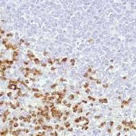 Immunohistochemistry (Formalin/PFA-fixed paraffin-embedded sections) - Anti-Neutrophil Elastase antibody [SP203] (AB183342)