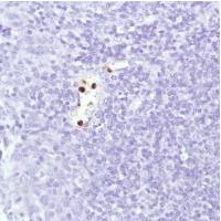 Immunohistochemistry (Formalin/PFA-fixed paraffin-embedded sections) - Anti-Neutrophil Elastase antibody [SP203] (AB183342)